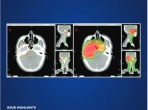 Precision Radiation Oncology青年编委会第二轮招募启事