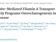 山一大附属肿瘤医院质子中心实验室刘志强教授团队研究成果揭示了骨髓瘤骨病发生的细胞力学生物学机制